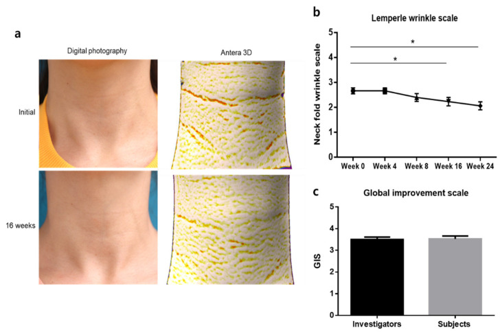 Neck wrinkles: clinical photographs and Antera 3D images at baseline and week 16, plus the paper's wrinkle-score charts (Figure 5, shown as published).